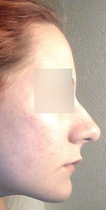 How to afford a surgery - Norway, Sweden, Denmark, Germany?