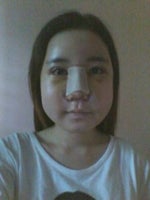 I Finally Did Plastic Surgery