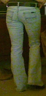 In NJ Area...expert at Liposculpture/fat Transfer? (photo)