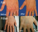 The Guide To Younger Looking Hands