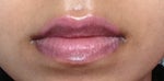 I had my lips tattooed but they came out too light