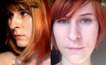 I think I want a rhinoplasty, but...