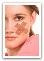 Scar treatments