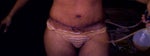 Is my bellybutton position too close to scar?