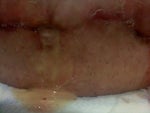 I have a super gross situation happening...need advise ASAP!