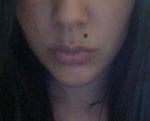 I Need Help Locating a Lip Lift Surgeon Near Illinois.