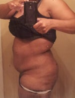 I'm sooooo nervous!! Surgery tomorrow!