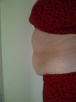 Finally decided to get ready of my double rolls of......................fat.