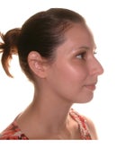 Before and After Photos, why won't they show them to me?