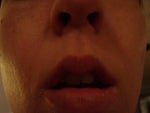 Self conscious over oddly shaped lips