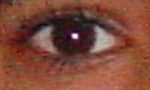 Eye englarment for small eye