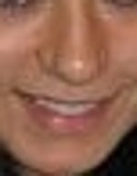 Is there a surgeon who can offer a similar nasal tip rhino in NYC / NJ?