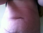 Are There Any Dr Near Nashua NH That Need a Volunteer or Would Do Pro Bono Laser Lipo? (photo)