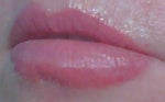 Anyone have a recommendation for tattoo removal in Marin County area of California? Bad lip job-color goes 3/16" below my bottom