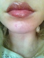 Is this a scar? or a normal part of the healing process after permanent lip colour
