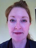 Can anyone recommend a good surgeon in phila area for eyelid consult?