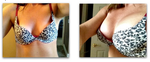 A Cup to C Cup Breast Implants