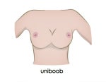 urban glossary to breast augmentation and implant terms