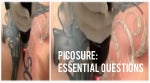 most asked questions about picosure answered by dr. email tanghetti
