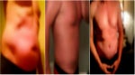 The Most Talked-About Male Tummy Tucks: 10 Before and Afters