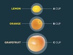 breast implant infographic