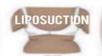 Liposuction Lexicon: Your Urban Glossary To Lipo Lingo