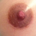 Incision on my right nipple.  Hardly noticeable already and I'm still healing.